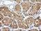 Aldolase, Fructose-Bisphosphate B antibody, LS-C172769, Lifespan Biosciences, Immunohistochemistry paraffin image 