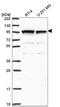 Adhesion G Protein-Coupled Receptor G2 antibody, NBP2-55504, Novus Biologicals, Western Blot image 