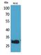 CD200 Molecule antibody, A01512, Boster Biological Technology, Western Blot image 