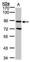 G Protein-Coupled Receptor Kinase 2 antibody, PA5-28609, Invitrogen Antibodies, Western Blot image 
