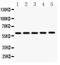 Cystathionine-Beta-Synthase antibody, RP1041, Boster Biological Technology, Western Blot image 