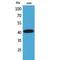 Selectin L antibody, LS-C387150, Lifespan Biosciences, Western Blot image 