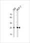 Carbonic Anhydrase 2 antibody, 62-809, ProSci, Western Blot image 