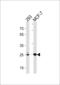 CAC antibody, 62-809, ProSci, Western Blot image 