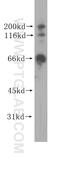 G Protein-Coupled Receptor Kinase 6 antibody, 11439-1-AP, Proteintech Group, Western Blot image 