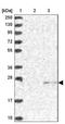 Zinc Ribbon Domain Containing 2 antibody, NBP2-13387, Novus Biologicals, Western Blot image 