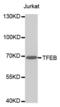 Transcription Factor EB antibody, abx003102, Abbexa, Western Blot image 