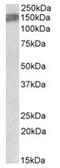 ALK Receptor Tyrosine Kinase antibody, AP31403PU-N, Origene, Western Blot image 