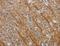 ABL Proto-Oncogene 1, Non-Receptor Tyrosine Kinase antibody, LS-C400536, Lifespan Biosciences, Immunohistochemistry paraffin image 