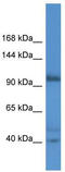 Actin Filament Associated Protein 1 Like 2 antibody, TA342880, Origene, Western Blot image 