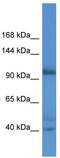 Actin filament-associated protein 1-like 2 antibody, TA342880, Origene, Western Blot image 