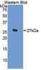 Interleukin 1 Beta antibody, LS-C299483, Lifespan Biosciences, Western Blot image 