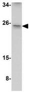 ADP Ribosylation Factor Like GTPase 15 antibody, GTX31973, GeneTex, Western Blot image 