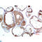 Transthyretin antibody, LS-C813247, Lifespan Biosciences, Immunohistochemistry paraffin image 