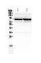 Solute Carrier Family 6 Member 1 antibody, A05109, Boster Biological Technology, Western Blot image 