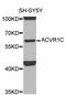 Activin A Receptor Type 1C antibody, MBS127029, MyBioSource, Western Blot image 