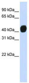 Transforming Growth Factor Beta 1 Induced Transcript 1 antibody, TA345186, Origene, Western Blot image 