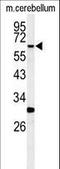 Receptor Interacting Serine/Threonine Kinase 3 antibody, LS-C97217, Lifespan Biosciences, Western Blot image 