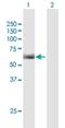 Immunoglobulin Heavy Constant Gamma 3 (G3m Marker) antibody, H00003502-B01P, Novus Biologicals, Western Blot image 