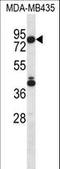 Sphingosine-1-Phosphate Lyase 1 antibody, LS-B10679, Lifespan Biosciences, Western Blot image 