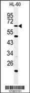 WD And Tetratricopeptide Repeats 1 antibody, 61-725, ProSci, Western Blot image 