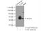 Vasodilator Stimulated Phosphoprotein antibody, 13472-1-AP, Proteintech Group, Immunoprecipitation image 