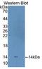 Carcinoembryonic Antigen Related Cell Adhesion Molecule 1 antibody, LS-C726163, Lifespan Biosciences, Western Blot image 