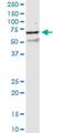 Nicotinic Acetylcholine Receptor beta 2 antibody, H00001141-M01, Novus Biologicals, Western Blot image 