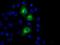 Protein Kinase, Membrane Associated Tyrosine/Threonine 1 antibody, GTX83877, GeneTex, Immunocytochemistry image 