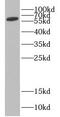 CDKN2A Interacting Protein antibody, FNab01566, FineTest, Western Blot image 