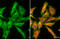 C-X-C Motif Chemokine Ligand 16 antibody, GTX632502, GeneTex, Immunocytochemistry image 