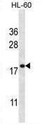 Transmembrane Protein 70 antibody, AP54292PU-N, Origene, Western Blot image 