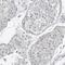 Kiaa0239 antibody, NBP1-81531, Novus Biologicals, Immunohistochemistry paraffin image 