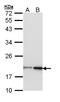 NME/NM23 Nucleoside Diphosphate Kinase 1 antibody, LS-C109484, Lifespan Biosciences, Western Blot image 