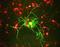 Neurofilament Medium antibody, NB300-134, Novus Biologicals, Immunocytochemistry image 