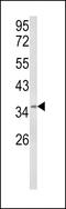 BRCA1-A complex subunit MERIT40 antibody, 63-522, ProSci, Western Blot image 