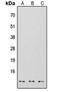 S100 Calcium Binding Protein A7 antibody, orb304575, Biorbyt, Western Blot image 