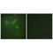 Trafficking Regulator Of GLUT4 (SLC2A4) 1 antibody, A12871, Boster Biological Technology, Immunohistochemistry frozen image 