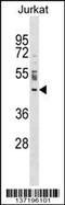 Nucleoporin 43 antibody, 59-121, ProSci, Western Blot image 