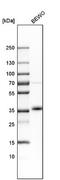 Growth Differentiation Factor 15 antibody, NBP1-81050, Novus Biologicals, Western Blot image 