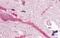 G Protein-Coupled Receptor 160 antibody, GTX71087, GeneTex, Immunohistochemistry paraffin image 