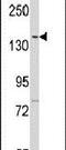 Lemur Tyrosine Kinase 2 antibody, PA5-13935, Invitrogen Antibodies, Western Blot image 