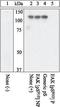 Protein Tyrosine Kinase 2 antibody, GTX24794, GeneTex, Western Blot image 
