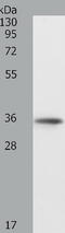 Quiescin Sulfhydryl Oxidase 1 antibody, TA321559, Origene, Western Blot image 