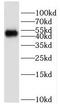 Homeobox Containing 1 antibody, FNab03917, FineTest, Western Blot image 