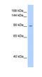 Oncostatin M Receptor antibody, NBP1-62543, Novus Biologicals, Western Blot image 