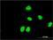 Zinc Finger And SCAN Domain Containing 31 antibody, H00064288-M03, Novus Biologicals, Immunofluorescence image 