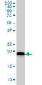 SRI antibody, LS-C198259, Lifespan Biosciences, Western Blot image 