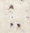 Leucine Rich Repeat Containing G Protein-Coupled Receptor 5 antibody, ab75732, Abcam, Immunohistochemistry paraffin image 