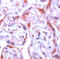 Matrix Metallopeptidase 1 antibody, ADI-905-472-1, Enzo Life Sciences, Immunohistochemistry paraffin image 